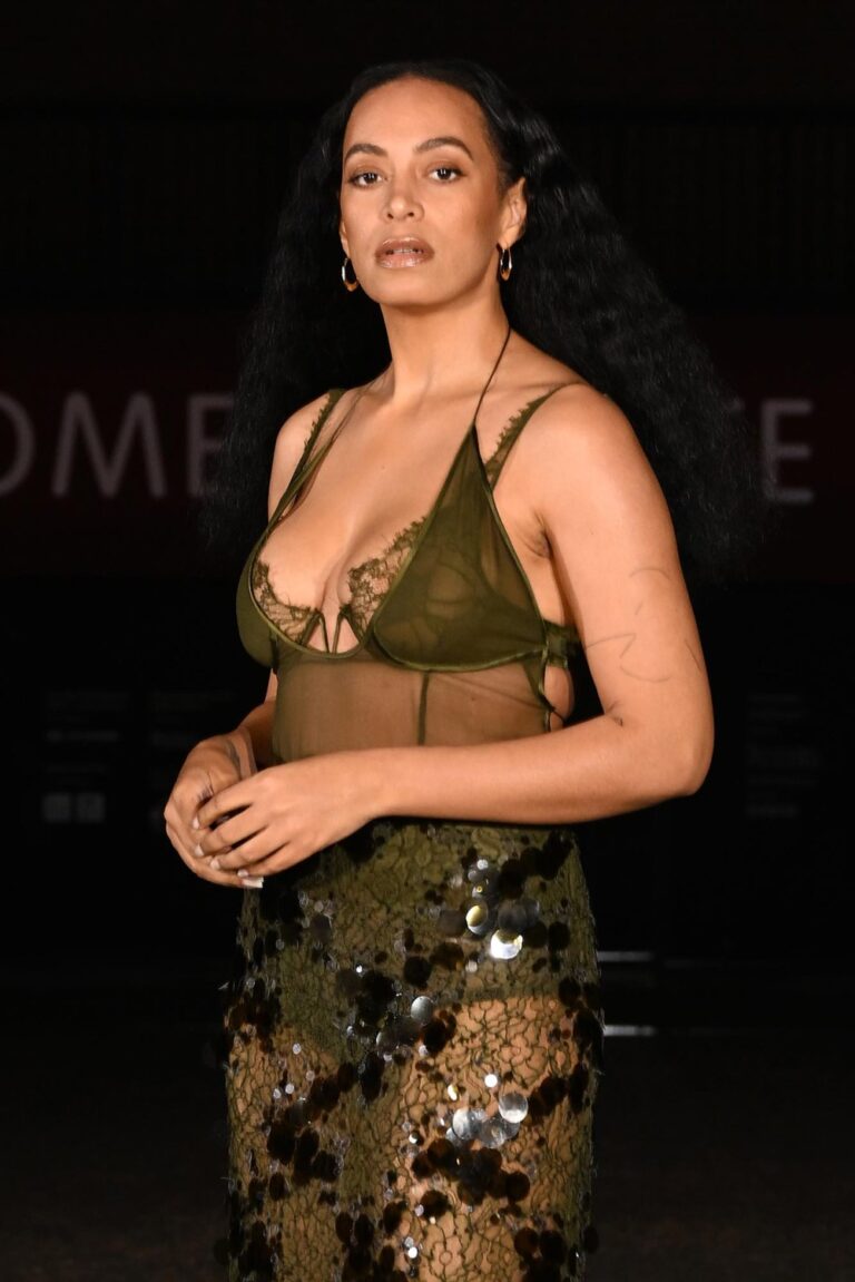 1Solange Knowles Reveals She Is Fighting Multiple Autoimmune Disorders